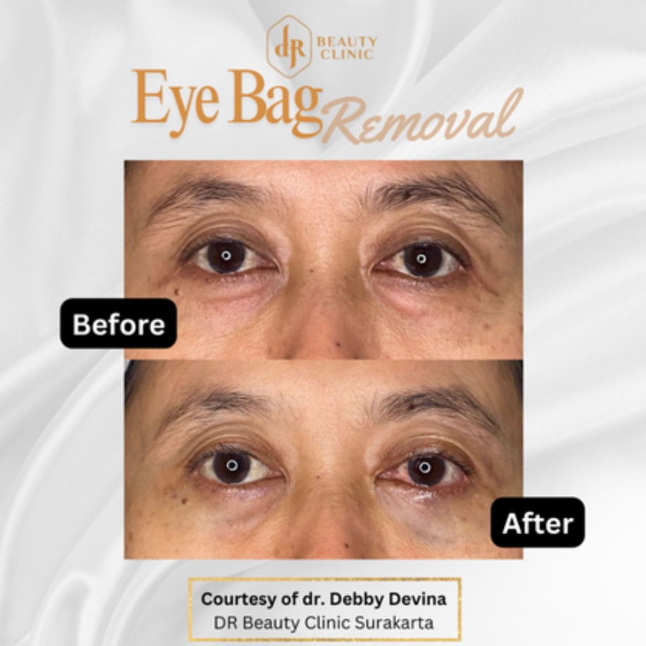 Screenshot-2025-02-21-at-09.18.55