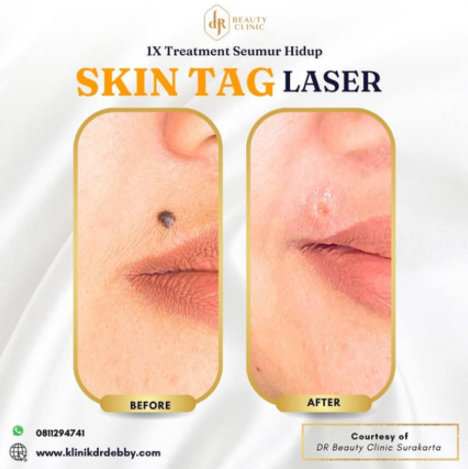 Screenshot-2025-02-21-at-10.01.35