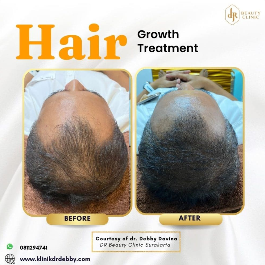 Screenshot-2025-02-21-at-10.03.52