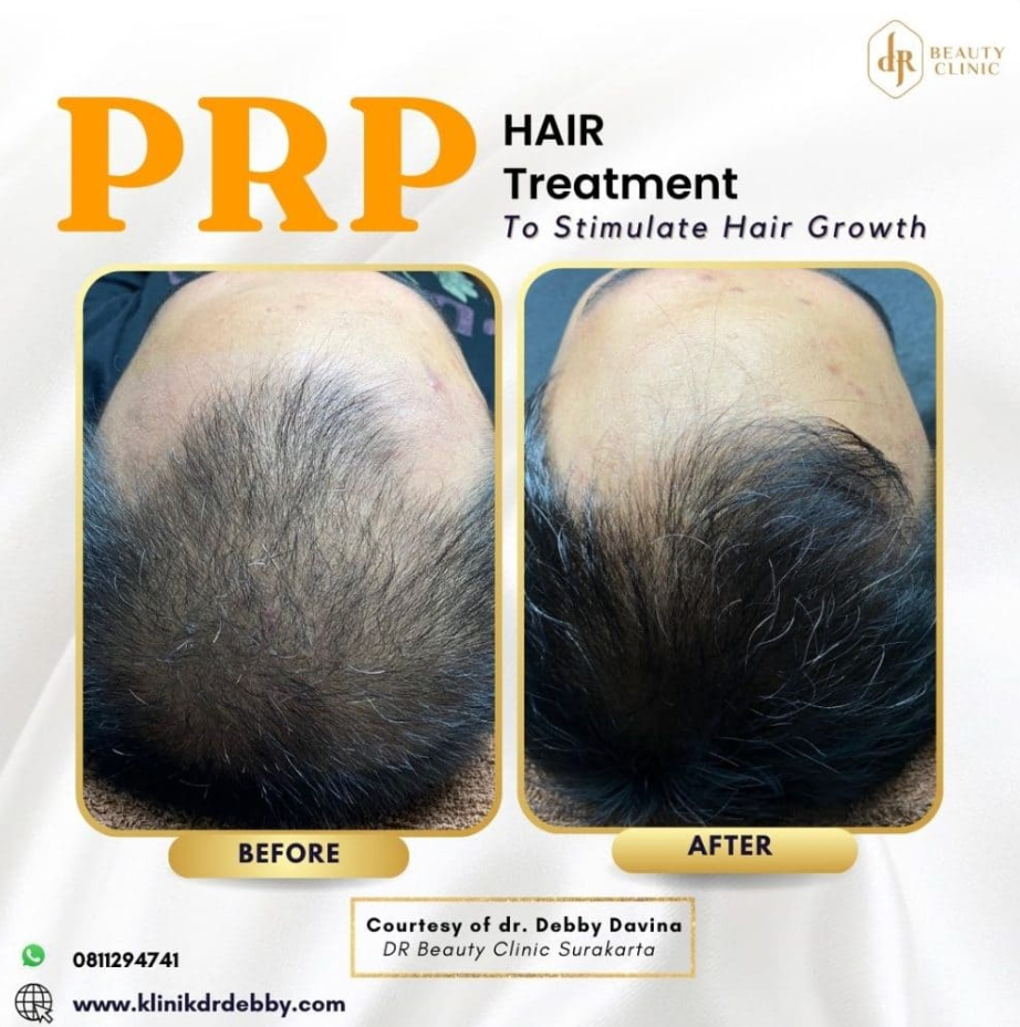 Screenshot-2025-02-21-at-10.04.21