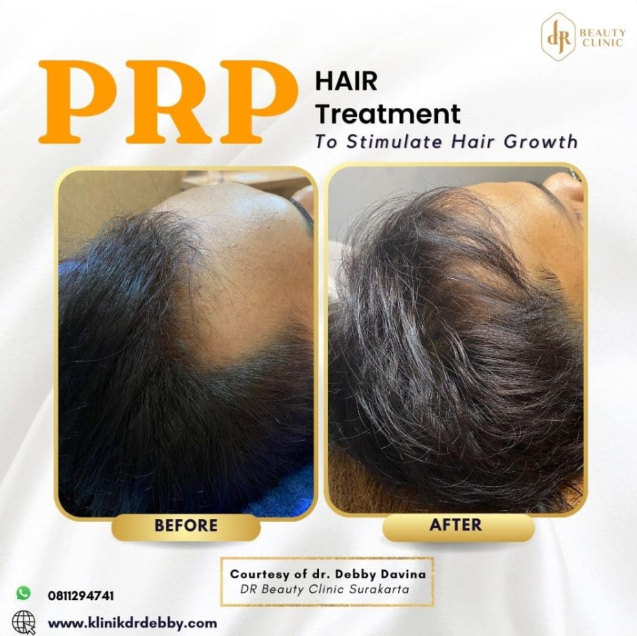 Screenshot-2025-02-21-at-10.04.47