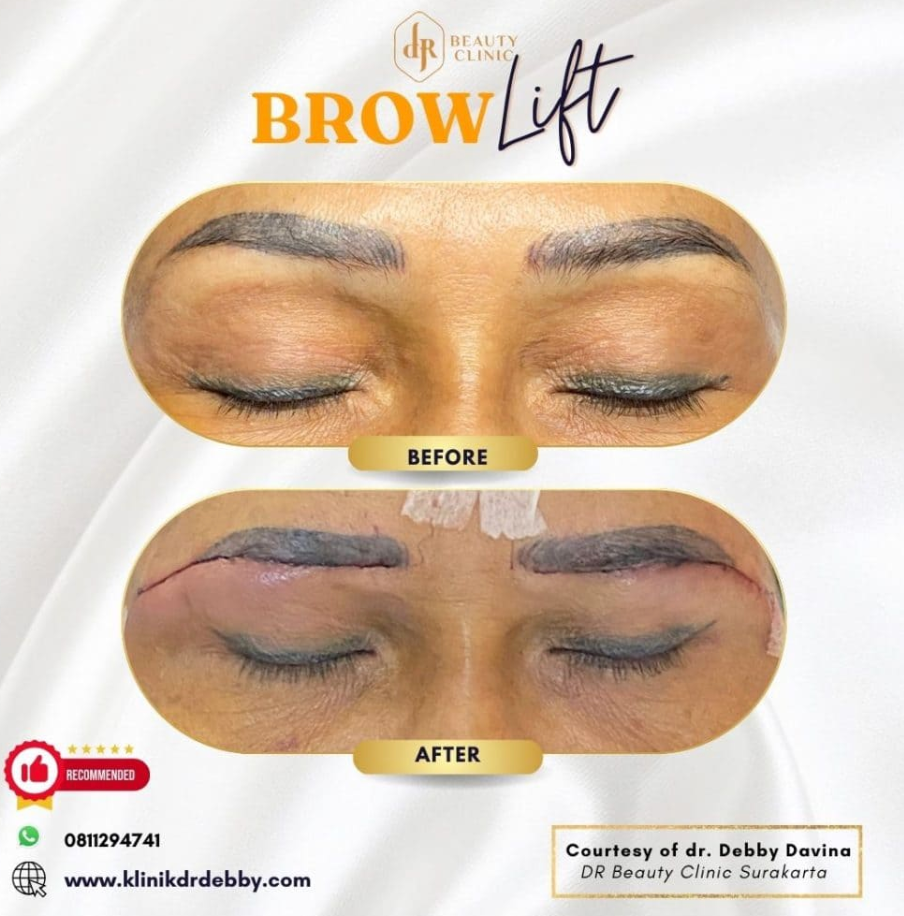 Screenshot-2025-02-21-at-10.16.22