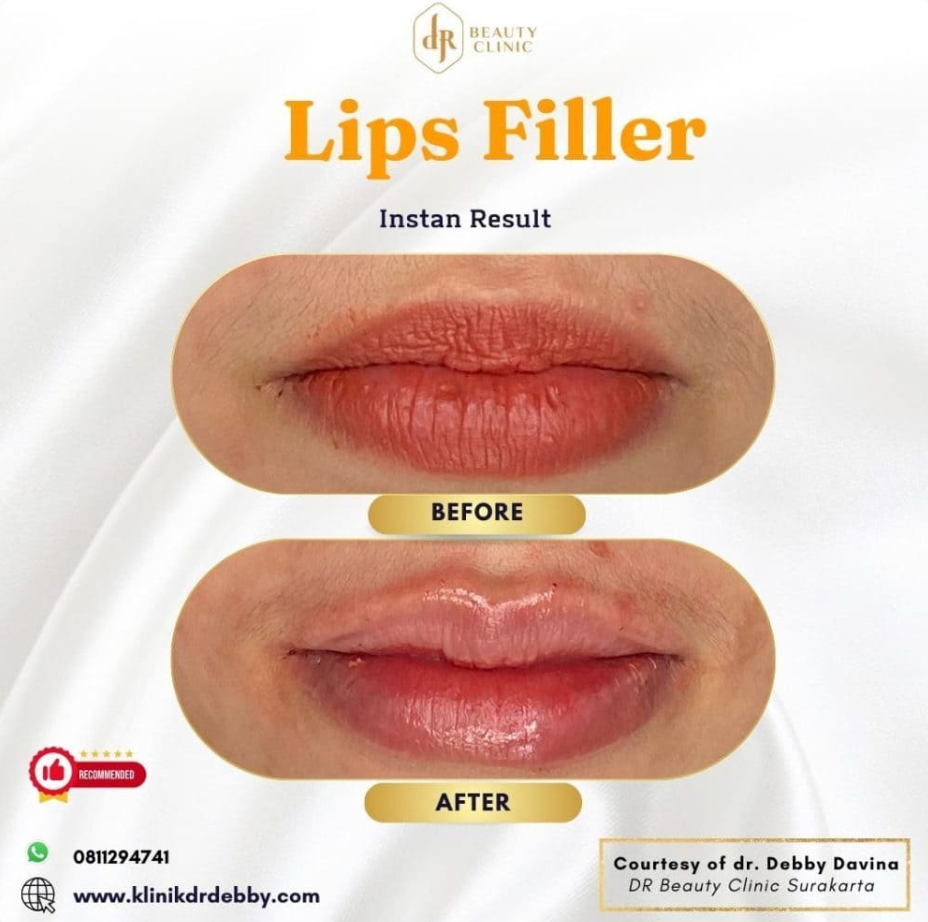 Screenshot-2025-02-21-at-10.31.52