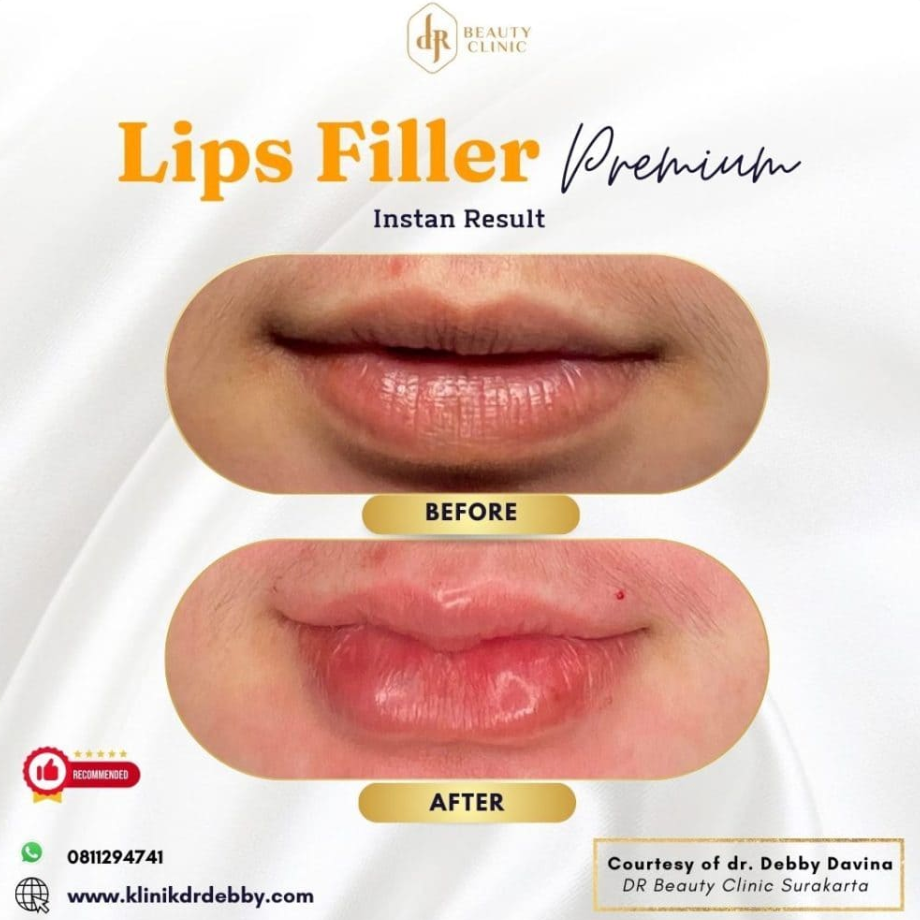 Screenshot-2025-02-21-at-10.32.11