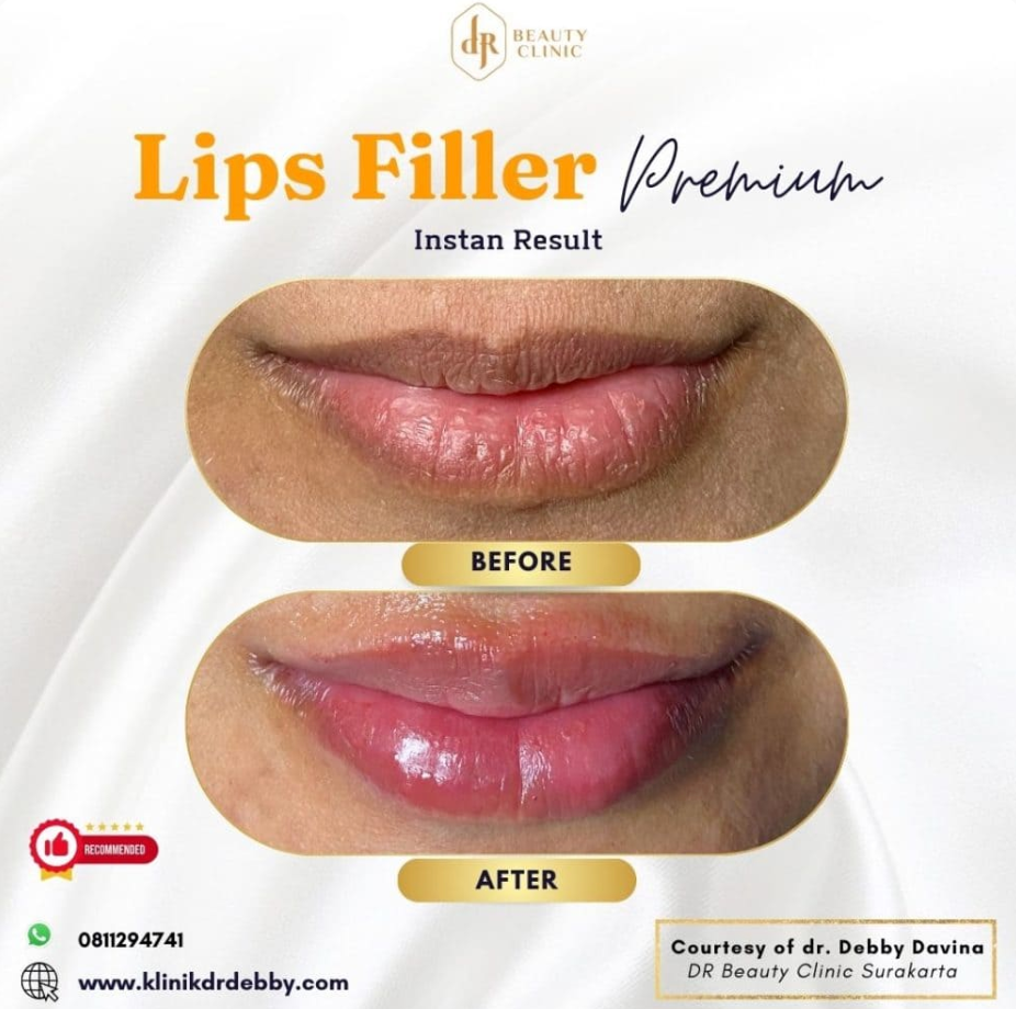 Screenshot-2025-02-21-at-10.32.30