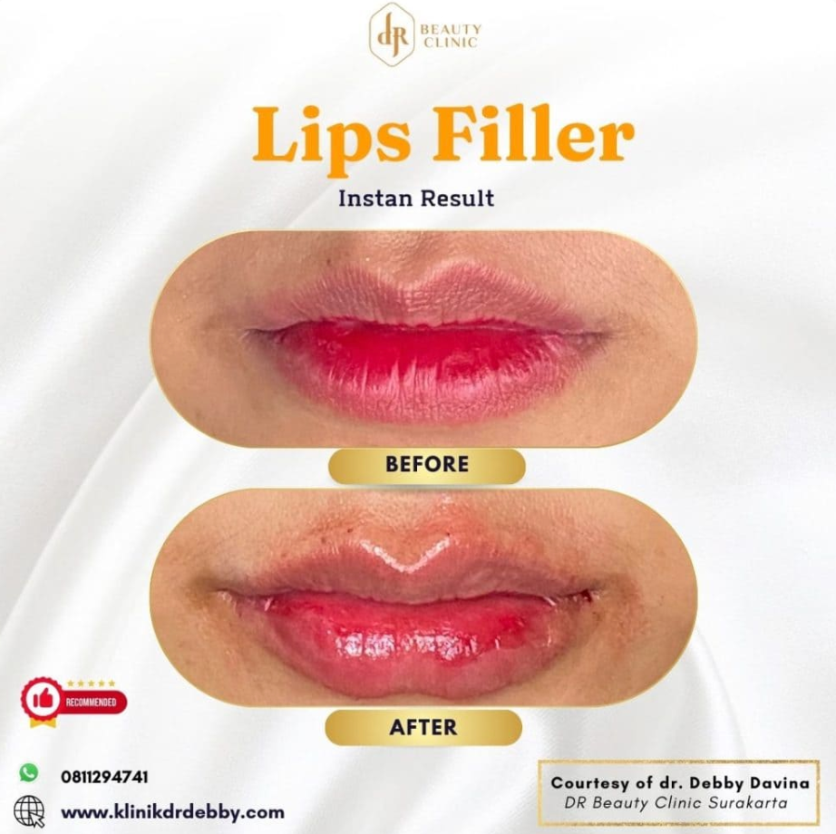 Screenshot-2025-02-21-at-10.32.49